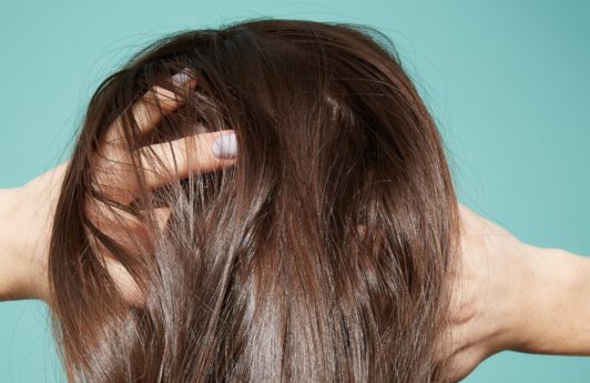 Thinning hair: Close up of scalp brunette woman thinning hair