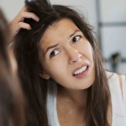 severe dandruff hair